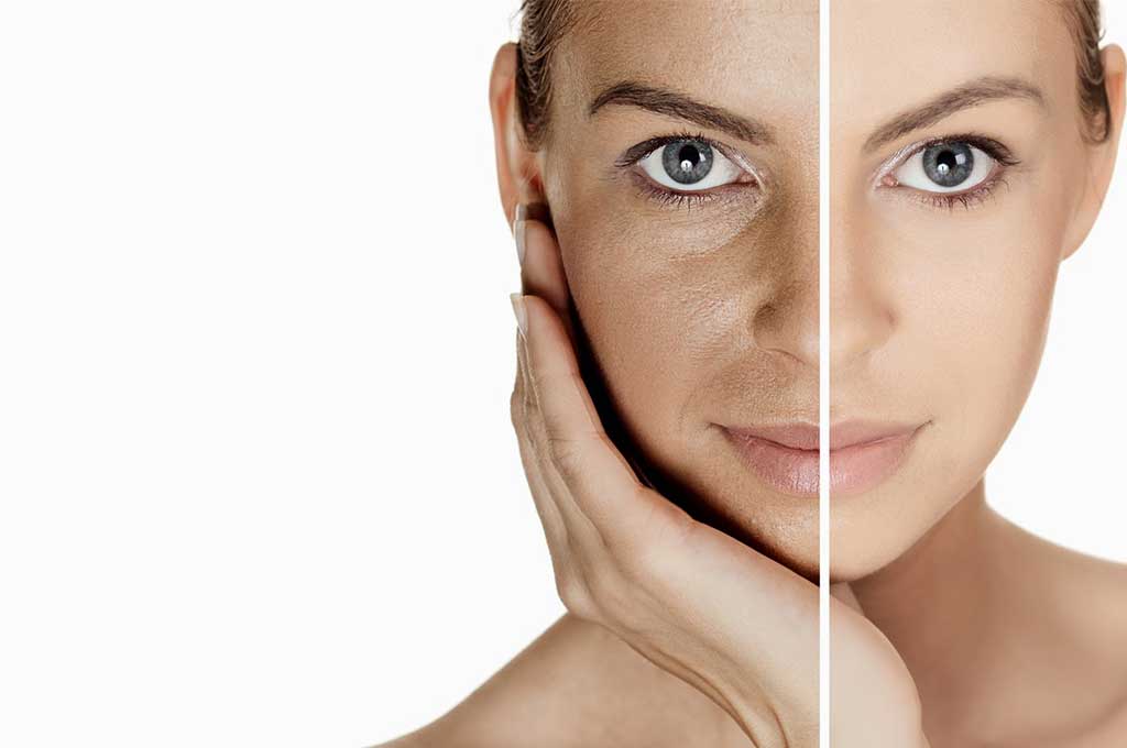 Tratamiento Antiage: Dermapen® + Boosters