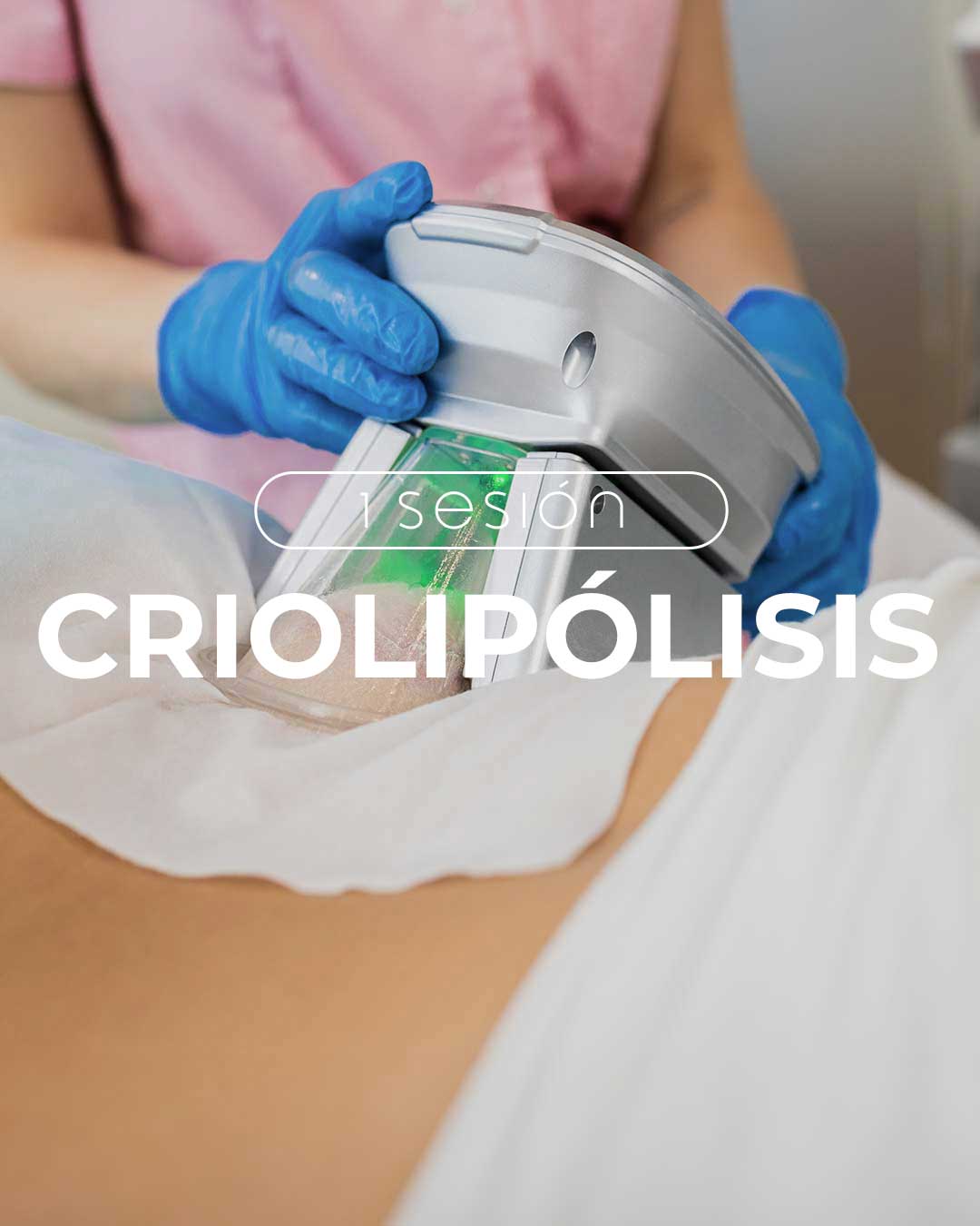 criolipólisis cdmx