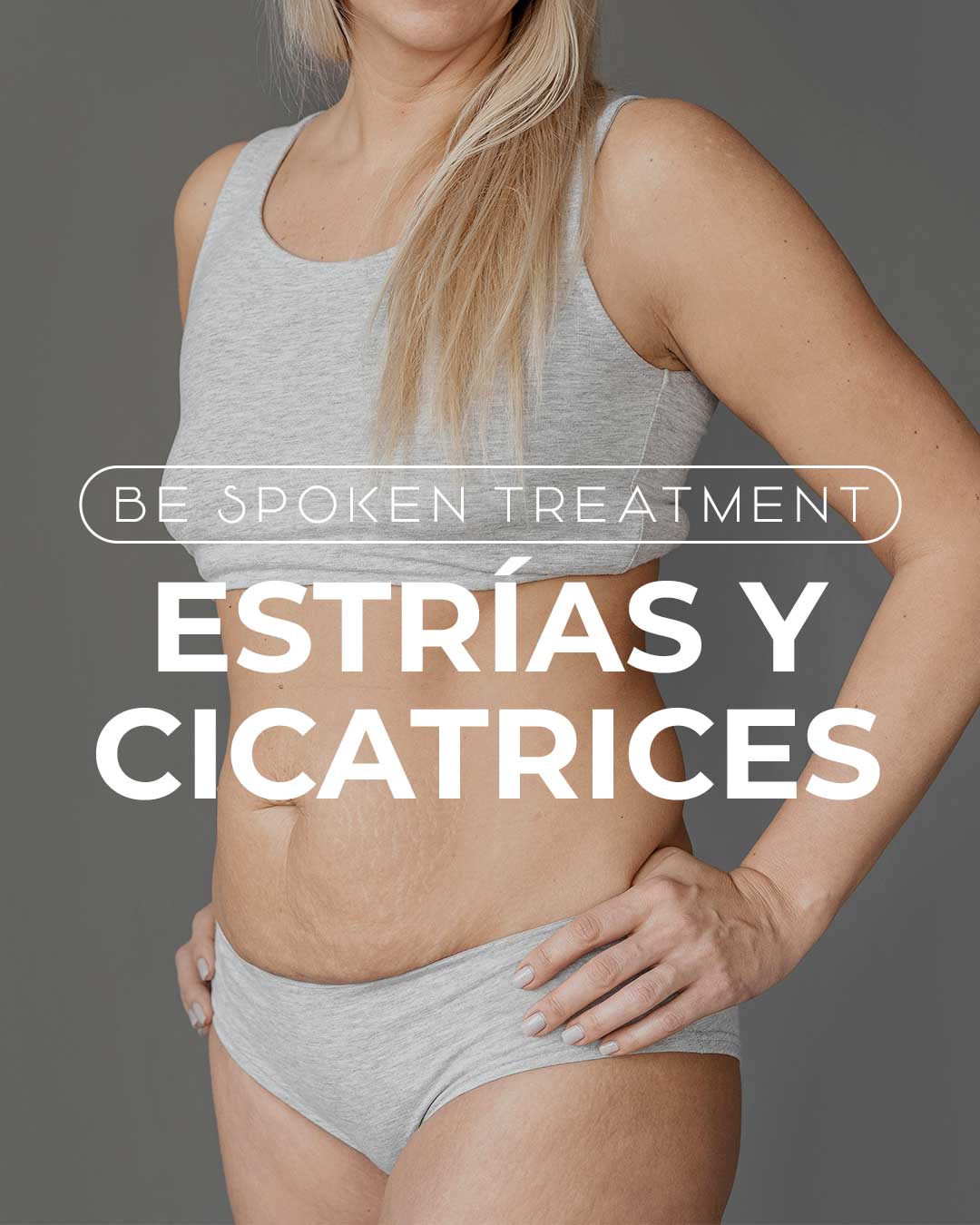 tratamientos para eliminar estrías y cicatrices corporales
