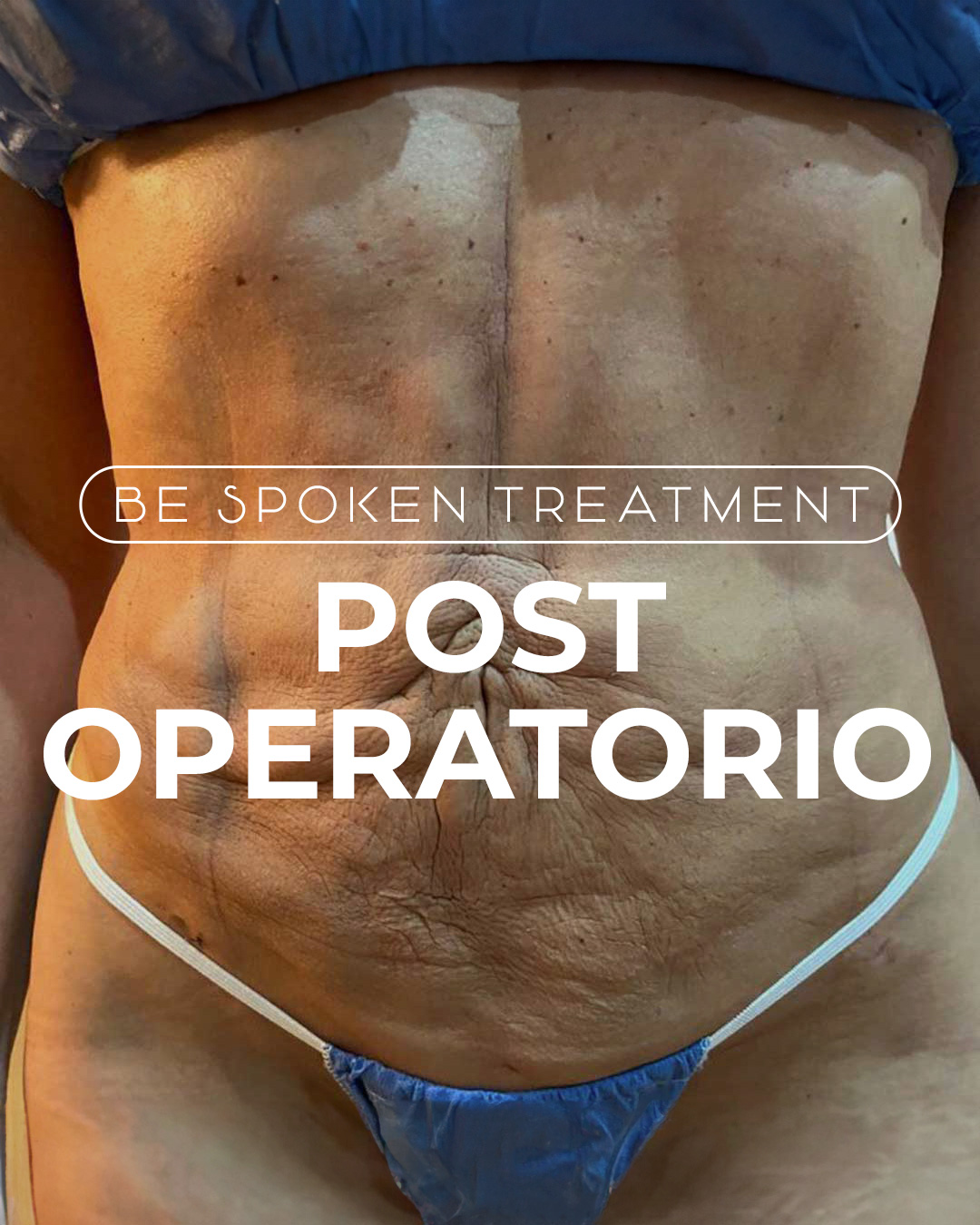programa post operatorio y drenaje linfático